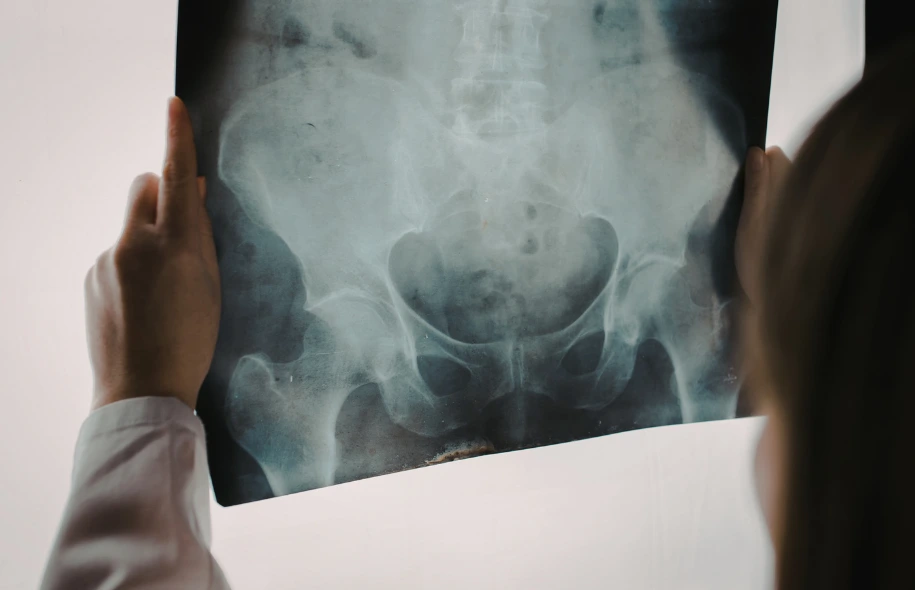Medical professional reviewing a pelvic X-ray image to assess possible fractures or internal injuries.