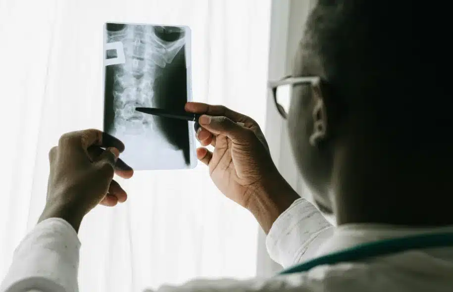 Medical professional reviewing a cervical spine X-ray while evaluating potential spinal cord injuries following a car accident.